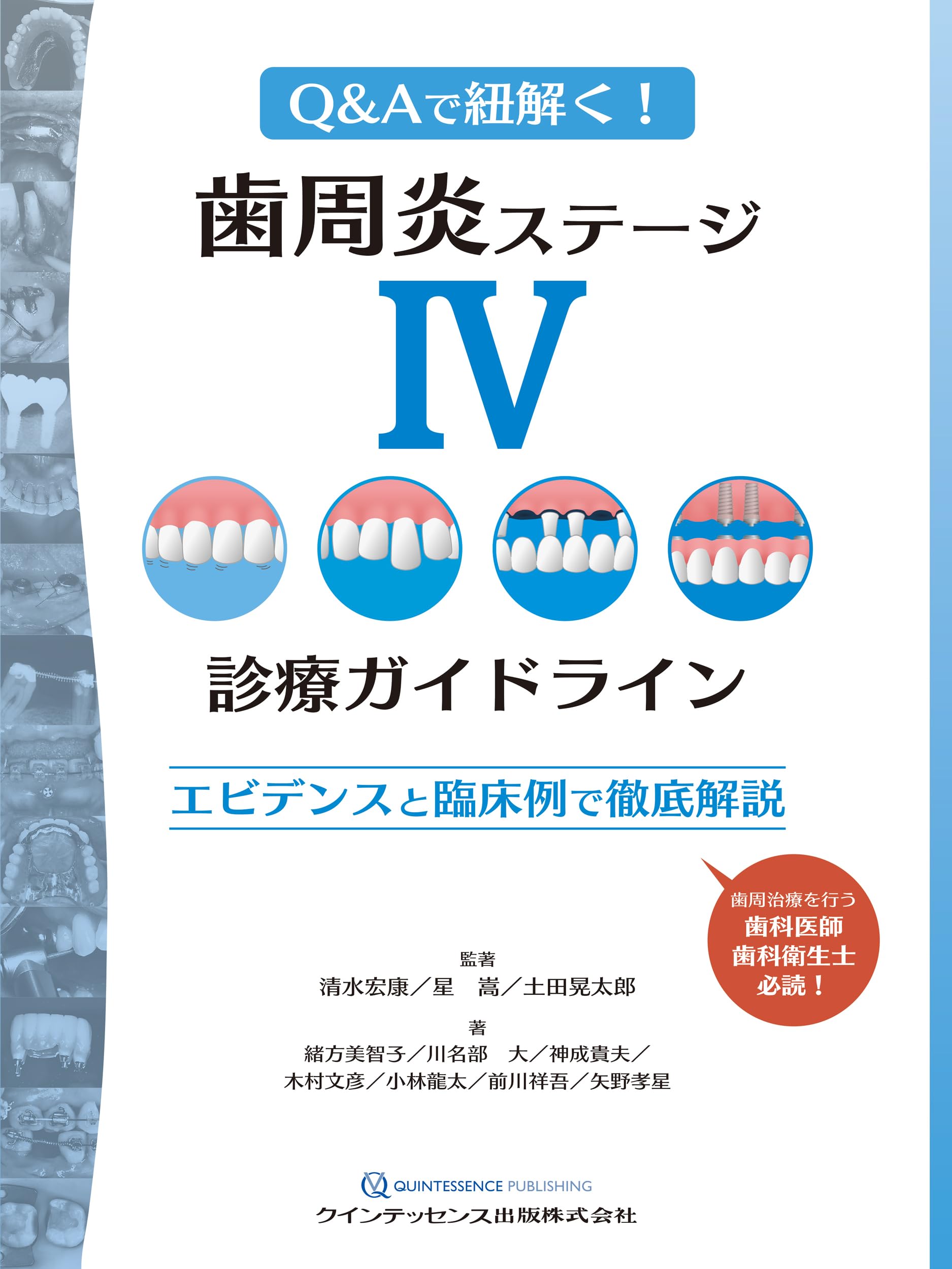 歯周炎ステージIV 診療ガイドライン 歯周炎ステージIV診療ガイドライン: エビデンスと臨床例で徹底解説