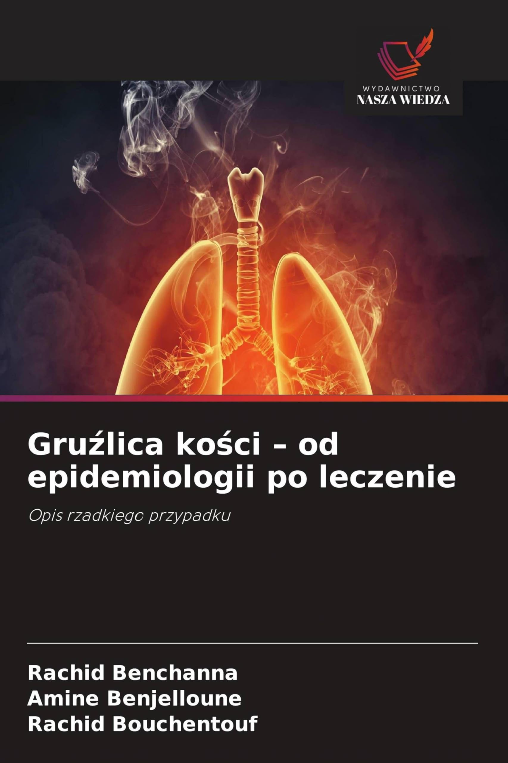 Gru¿lica ko¿ci - od epidemiologii po leczenie: Opis rzadkiego przypadku