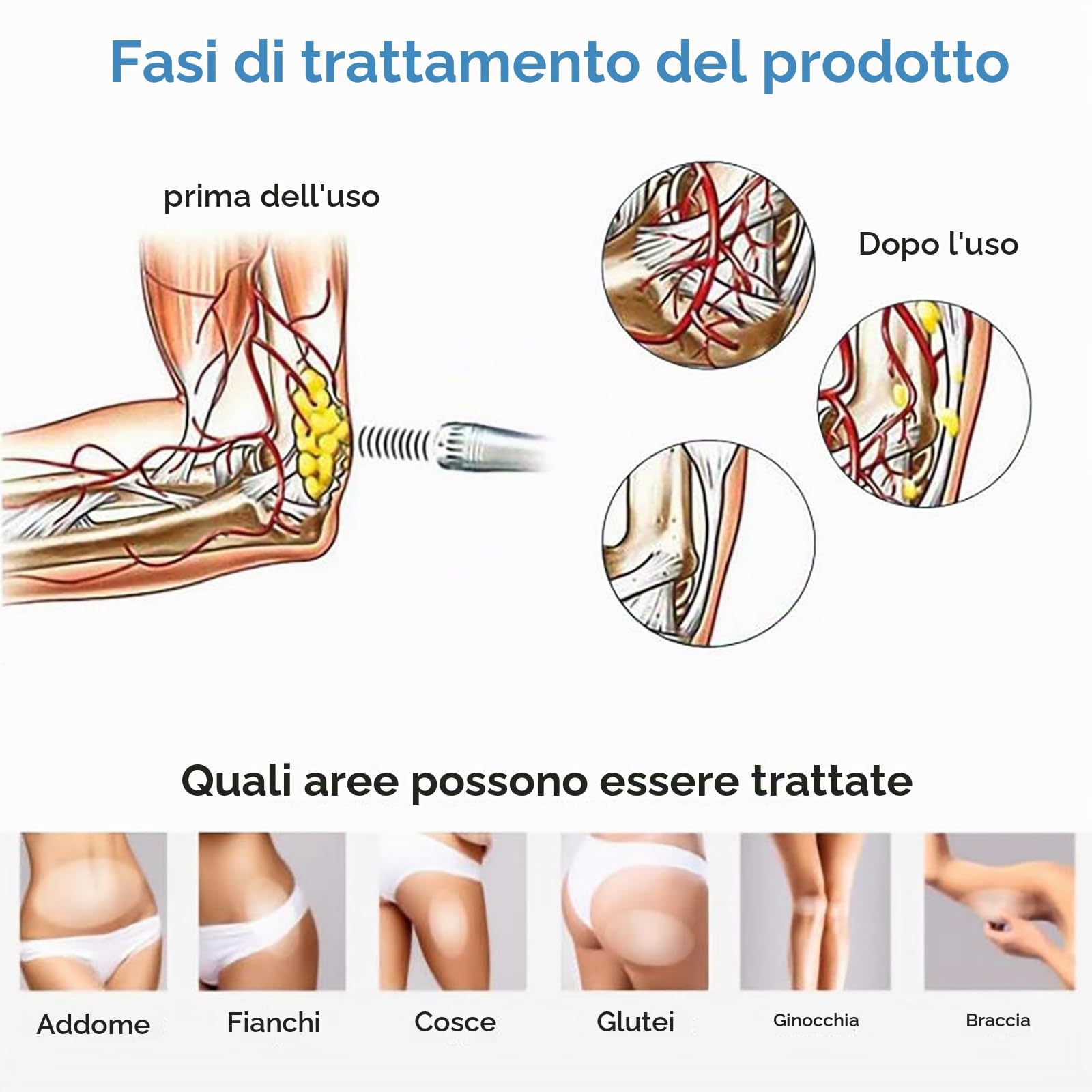 MObyat Apparecchio per Terapia a Onde d'urto, apparecchio per Terapia a Onde d'urto extracorporea elettromagnetica da 90 W, 10 testine massaggianti, Regolazione dell'energia 25-105 MJ