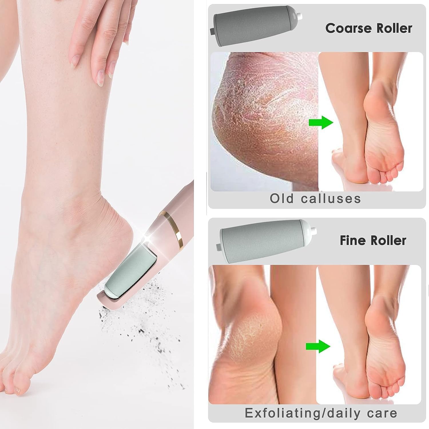 US1984 Callus Remover with 2 Interchangeable Head Rollers | Rechargeable for Foot Care | Callus & Dead Skin Removal Filer | 2 Speed | Pedicure Machine | Foot Scrubber for Dead Skin 3