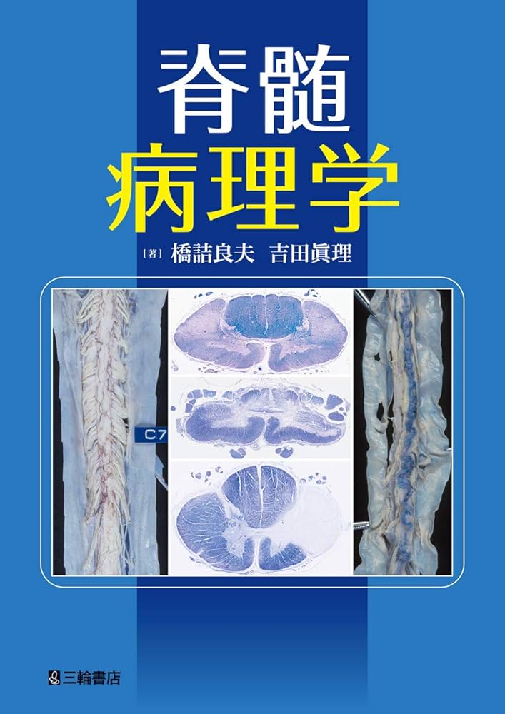 脊髄病理学 橋詰良夫 吉田眞理 脊髄病理学 橋詰良夫 吉田眞理 健康・医学