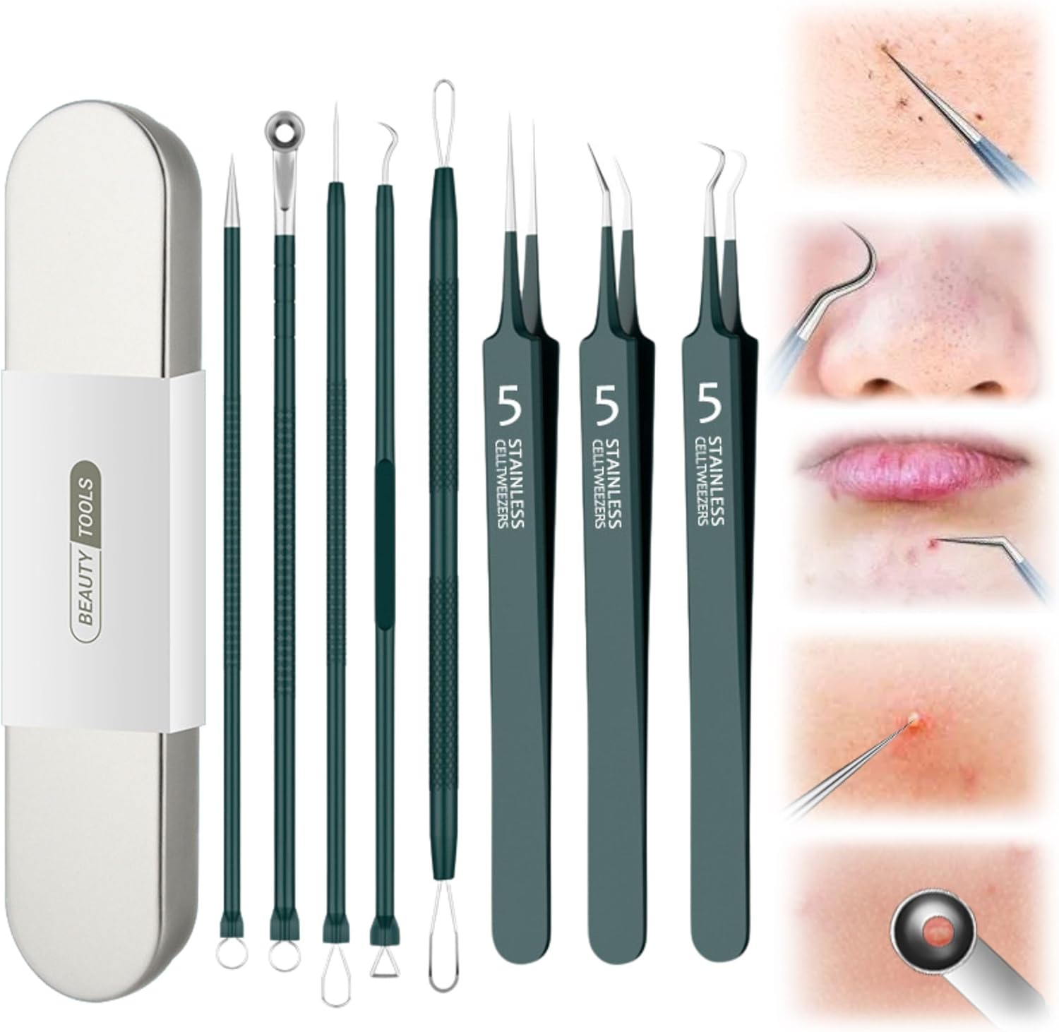 Stainless Steel Blackhead Remover Kit, Blackhead Tweezers, Professional Extractor Pimple Popper Tool Kit, Whiteheads Acne Needle Set for Face (Green)