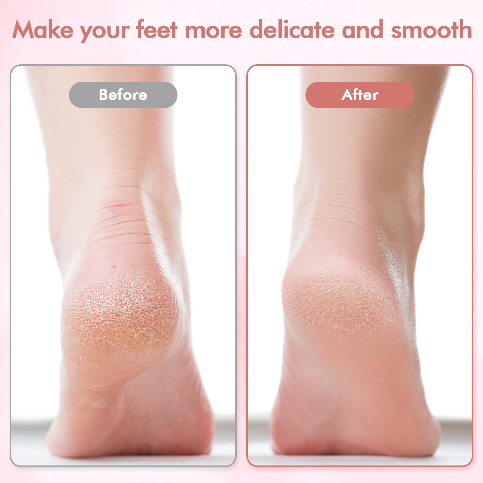 LIYUJSDZ Electric Foot File & Callus Remover, Professional Pedicure Tools for Dry, Calloused, Dead, Cracked and Hard Skin, Equipped with 2 Polishing Heads and 1 L Brush 1