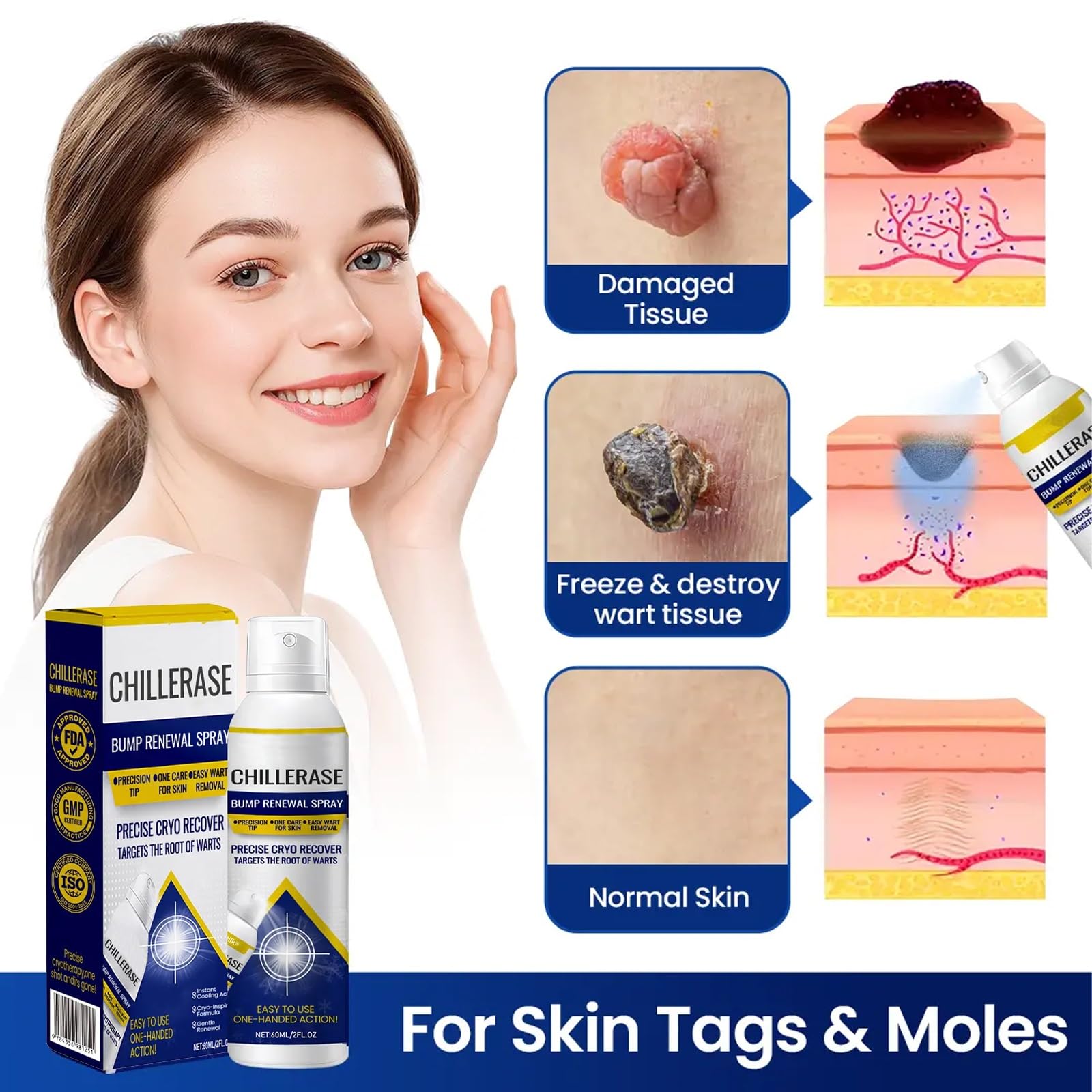 Spray Renovador for Protuberancias Chillerase, Nuevo Spray Profesional Herbs Haut (2026), Fórmula Calmante Y Refrescante, Reduce Las Imperfecciones De La Piel, Ingredientes Naturales(2PCS)