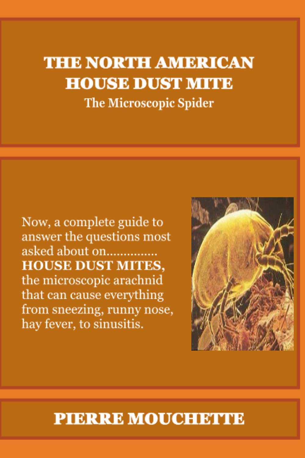 THE NORTH AMERICAN HOUSE DUST MITE: The Microscopic Spider