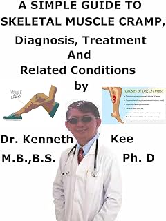 A Simple Guide To Skeletal Muscle Cramps, Diagnosis, Treatment And Related Conditions