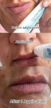 Lip Line Serum For Lines Above the Lips, Max Strength, With Hyaluronic Acid, Papaya Extract and Retinol