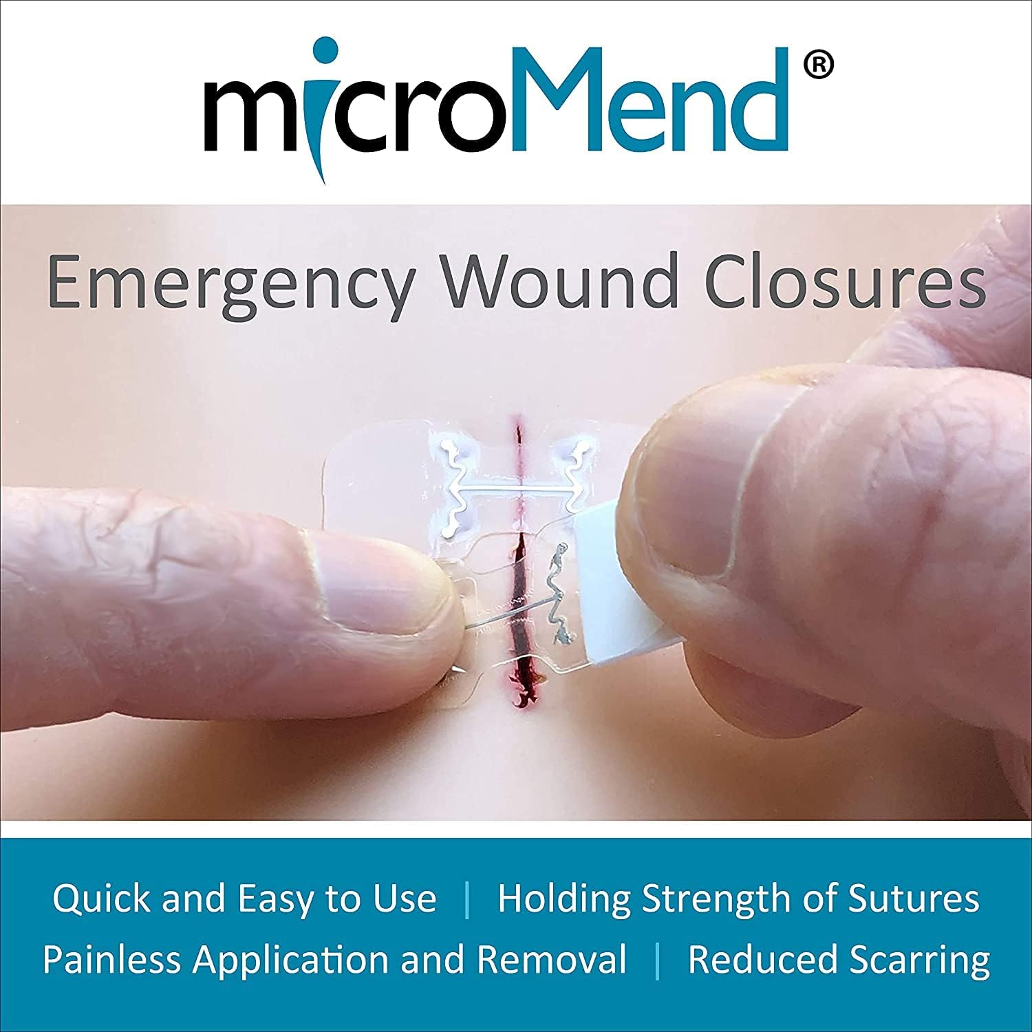 microMend Emergency Wound Closures Surgical Quality Laceration Repair Without Stitches - Think Ahead - Be Prepared - Add to Your Survival Kit, Camping Gear (Emergency Laceration Kit): Health & Personal Care