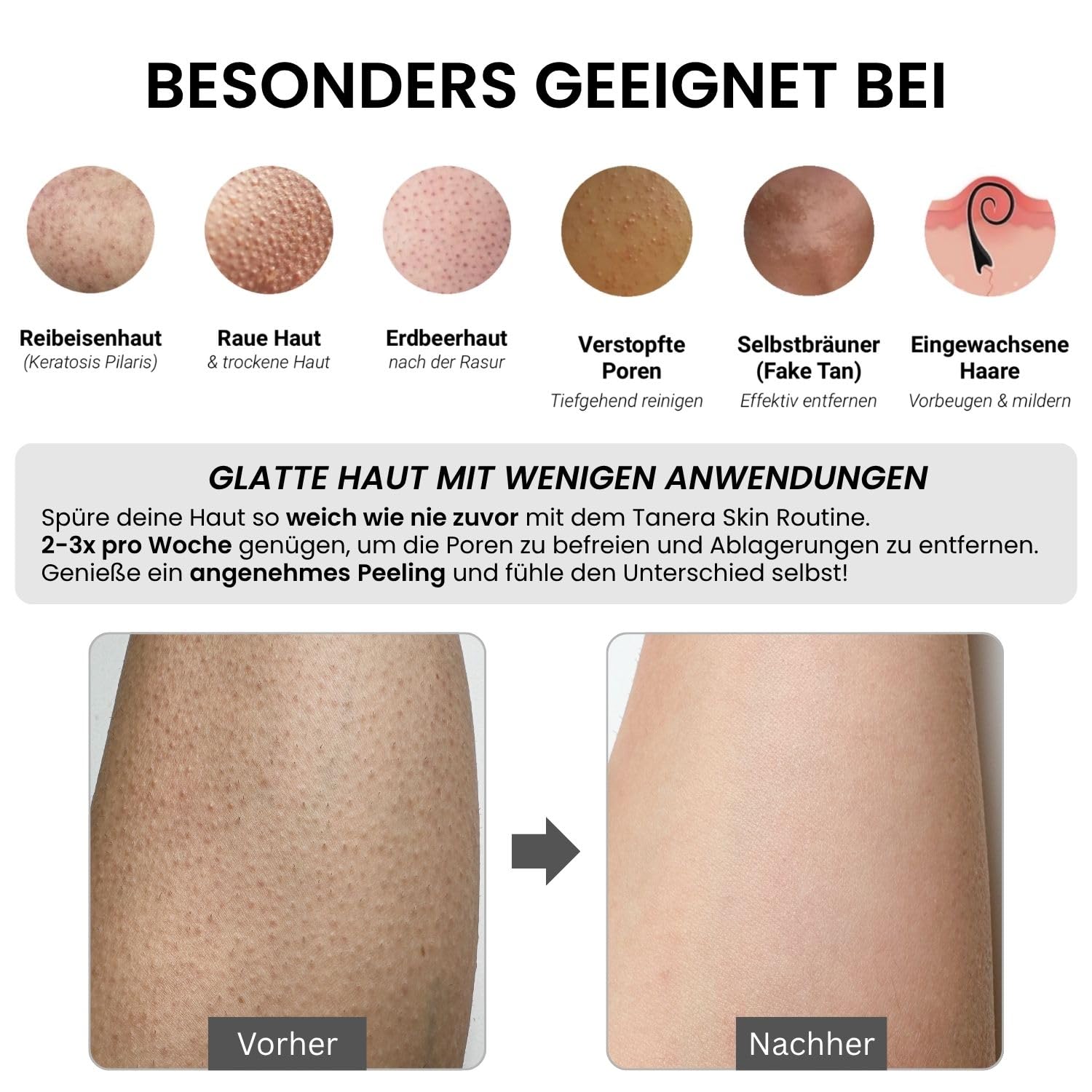 Tanera Skin Peeling Handschuh Set - Skincare für Keratosis Pilaris, raue Haut, Glycolic Acid Serum (Schwarz)