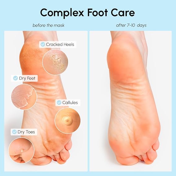 MAREE Foot Peeling Mask 3-in-1 Foot Mask for Dry Cracked Feet, Callus Remover Dead Skin Exfoliating Foot Peel Mask with Glycolic Acid Moisturizing Socks for Men Spa Self Care Gifts for Women