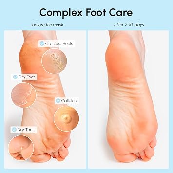 MAREE Foot Peeling Mask 3-in-1 Foot Mask for Dry Cracked Feet, Callus Remover Dead Skin Exfoliating Foot Peel Mask with Glycolic Acid Moisturizing Socks for Men Spa Self Care Gifts for Women