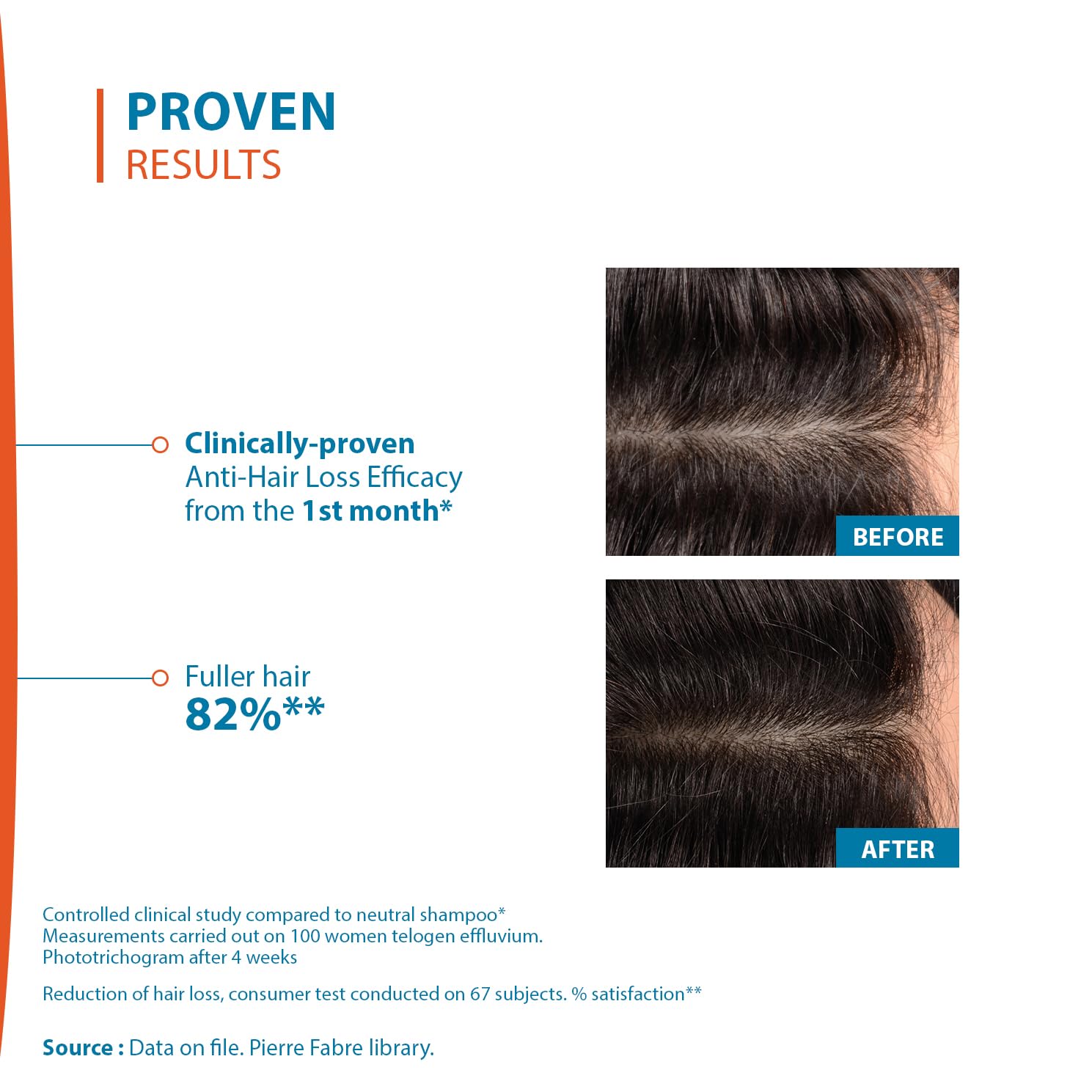 Ducray Creastim Reactiv Hair Loss Lotion 60 ml - Image 5