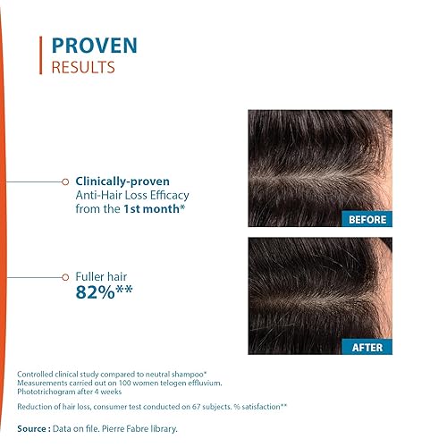 Miniatura 5 de Ducray Creastim Reactiv Loción para la pérdida del cabello 2.0 fl oz