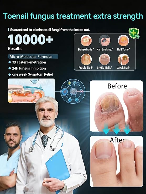 2026 Upgrade Toenail Fungus TreatmentMaximum Undecylenic Acid & Tea Tree
