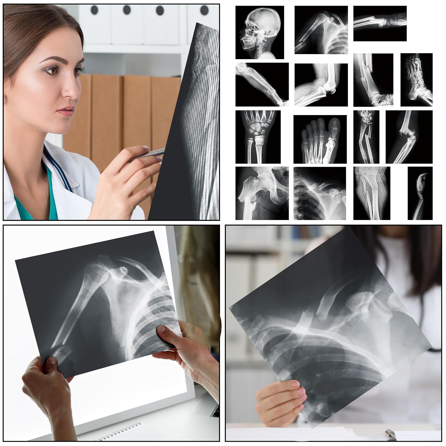 Sayglossy 15 Pcs Broken Bones x Ray Set Human x Rays Black and White Skeleton Pretend Xrays for Kids