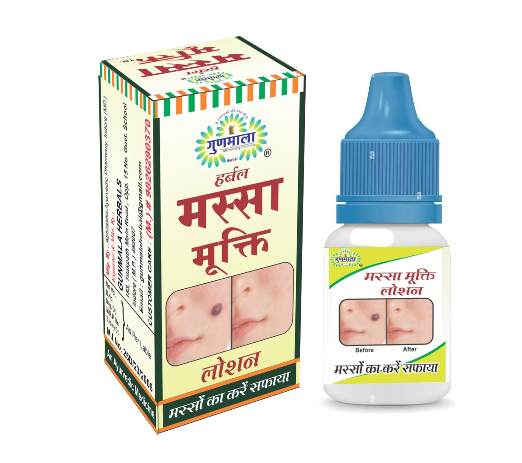 Wart Removal Lotion, For An Advanced Formula That Removes Massa Painless Solution And Save Time & Money, 5 Ml. Bottel Pack,Qty. - Pack Of 6