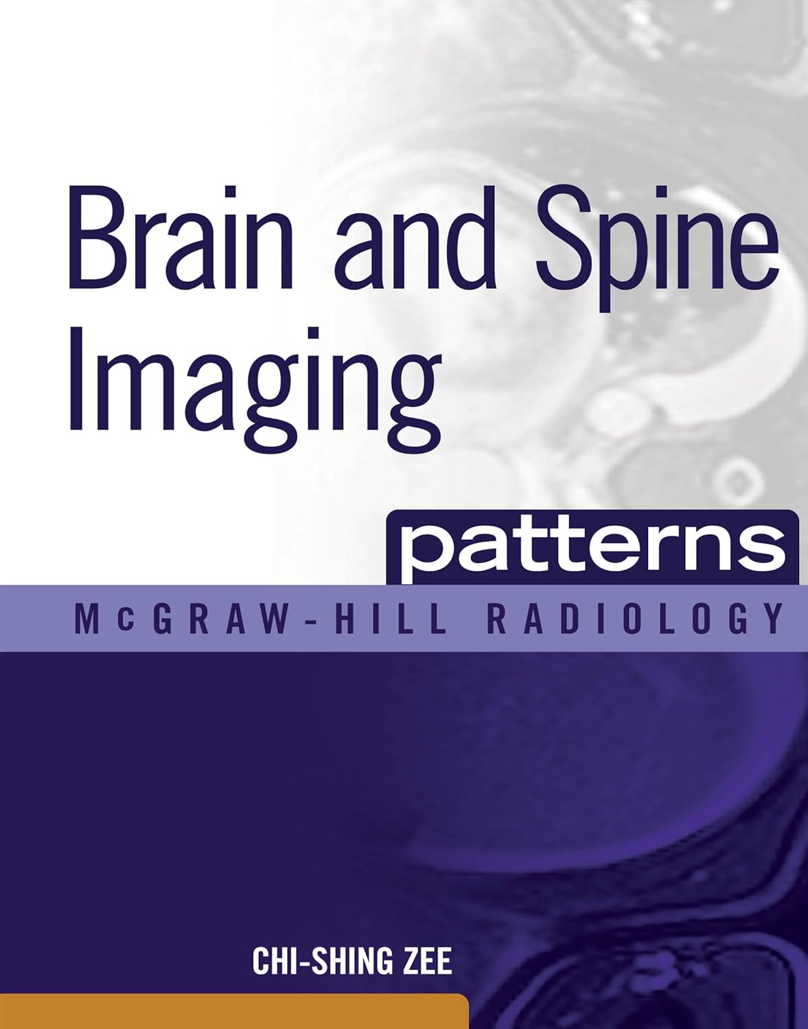 Brain and Spine Imaging Patterns: BRAIN & SPINE IMAGING (EBOOK) (McGraw-Hill Radiology)      1st Edition, Kindle Edition