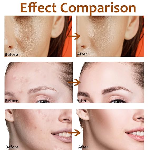 Pore Minimizer Serum for Face, Refines the Appearance of Enlarged Pores, Moisturizing Care for Dry-Looking Skin, Lactobionic Acid Pore Refining Serum For All Skin Types -1 Fl Oz