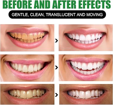 2pcs Bamboo Charcoal Deep Toothpaste, Bamboo Charcoal Toothpaste, Bamboo Charcoal deep Toothpaste, Cleaning Stains and Odour, whiten Teeth, 2pcs*100g