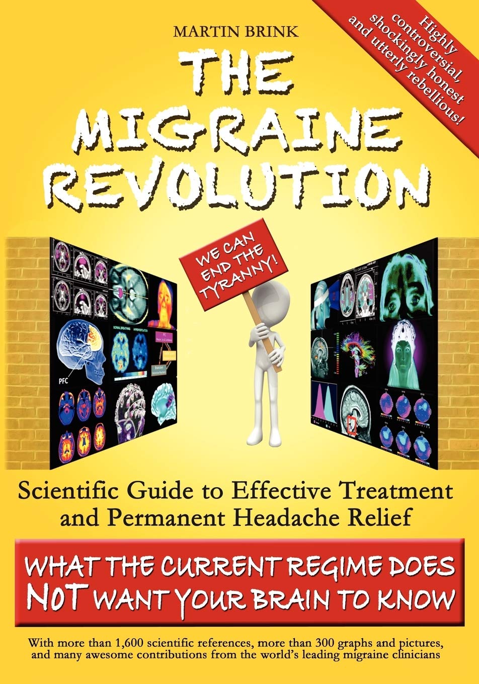 The Migraine Revolution: We Can End the Tyranny Scientific Guide to Effective Treatment and Permanent Headache Relief (Monochrome Edition)