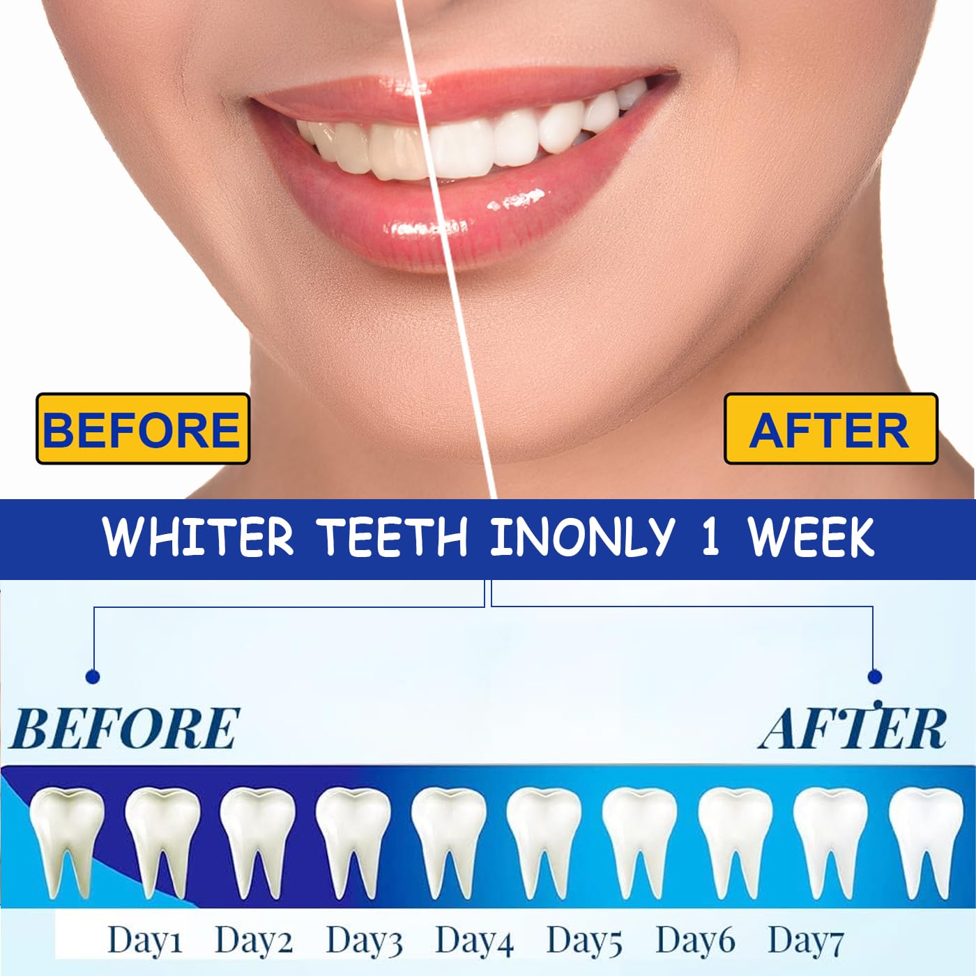 AYNKH 14 set di 28 strisce dentali sbiancanti per rimuovere le macchie di caffè affumicato, DENTAL Whitening Kit dentale whitenizer 3D White Strips con strumento di pulizia