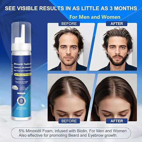 Miniatura 4 de Espuma tópica de minoxidil al 5 %, minoxidil para hombres y mujeres, impregnada con biotina, tratamiento para el crecimiento del cabello, soporta