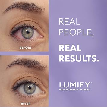 Lumify Redness Reliever Eye Drops, Works in 1 Minute, Lasts up to 8 Hours, Sterile, 0.08 fl oz (Pack of 2)