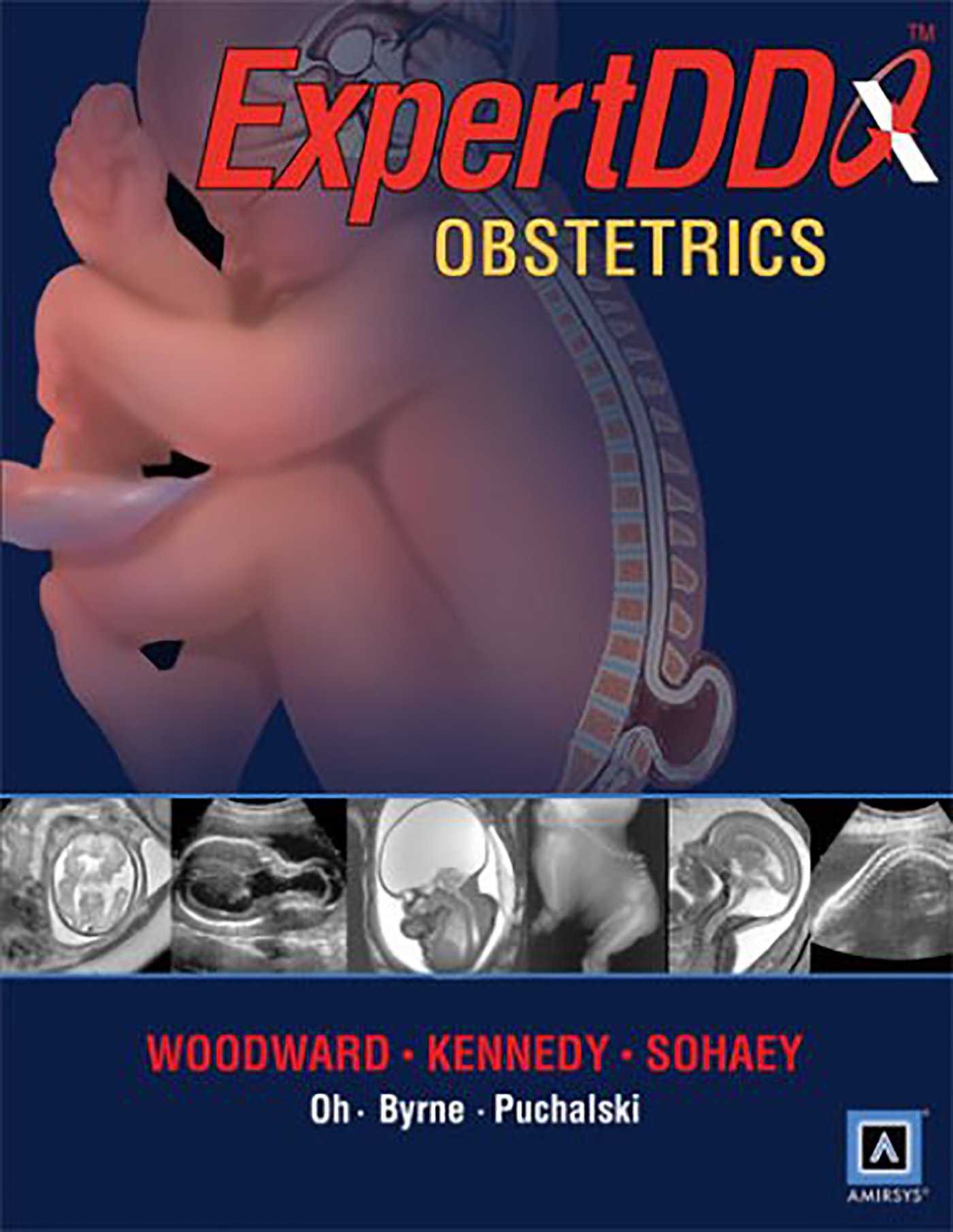 EXPERTddx: Obstetrics: Published by Amirsys (R) (EXPERTddx (TM))