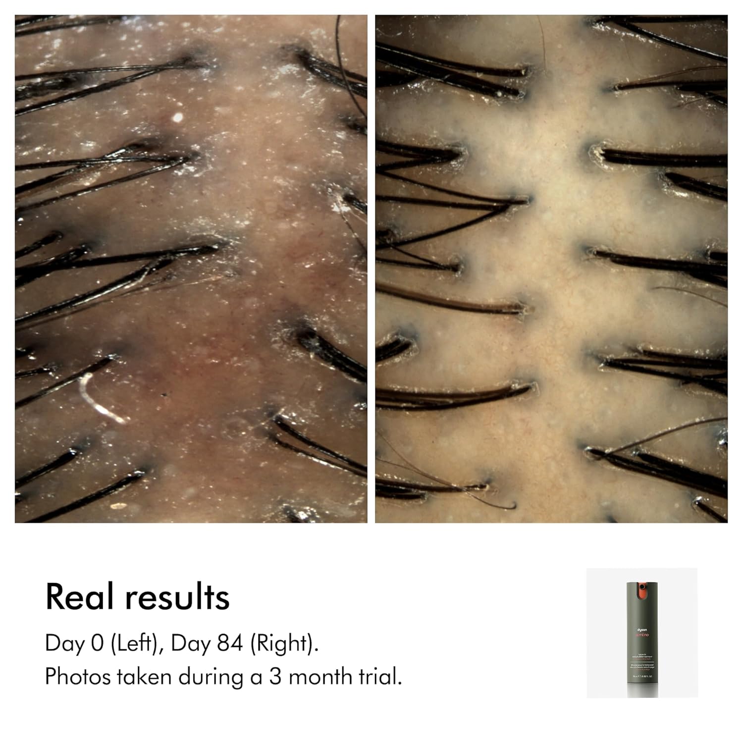 Dyson Amino™ leave-in scalp bubble treatment, 75mL