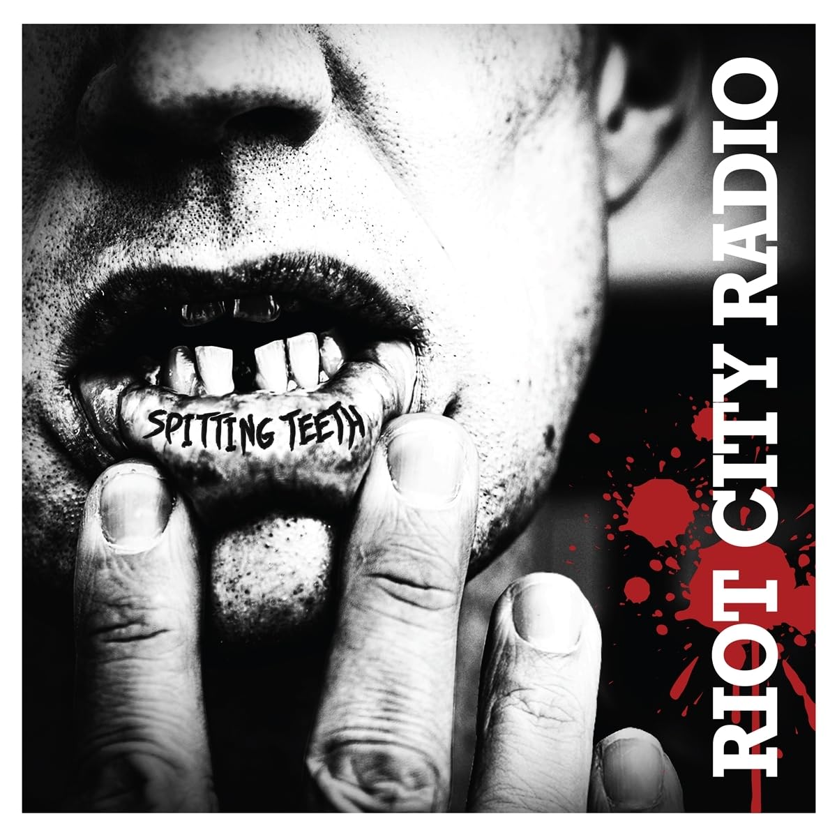 Riot City Radio Spitting Teeth (ltd Black Vinyl) LP New 4059251750307