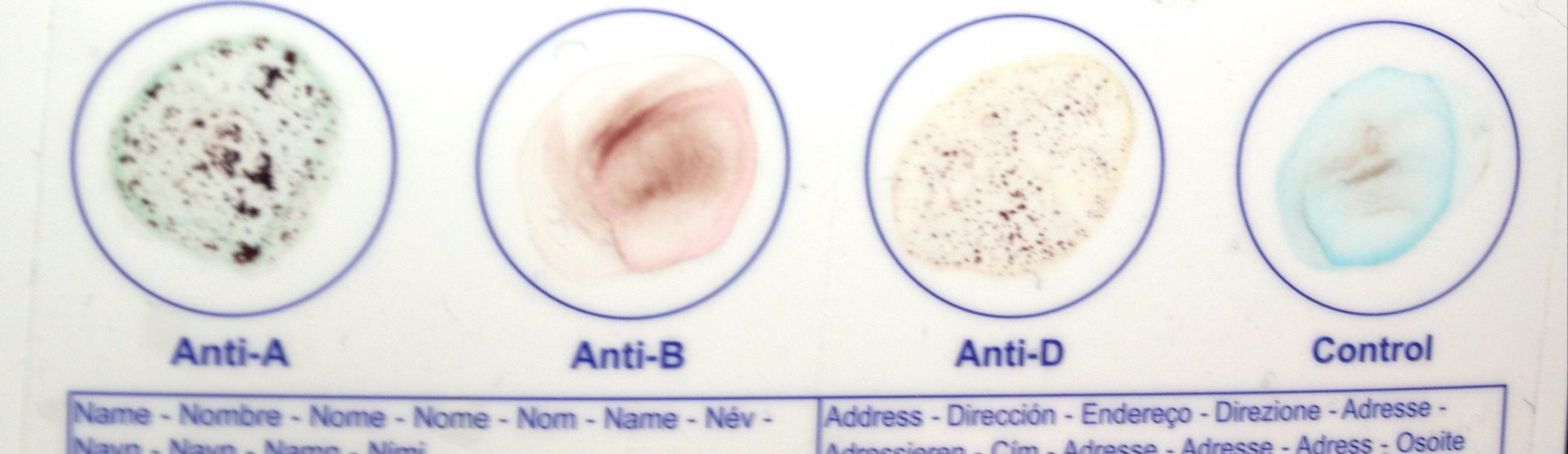 Good for those scared of needles.