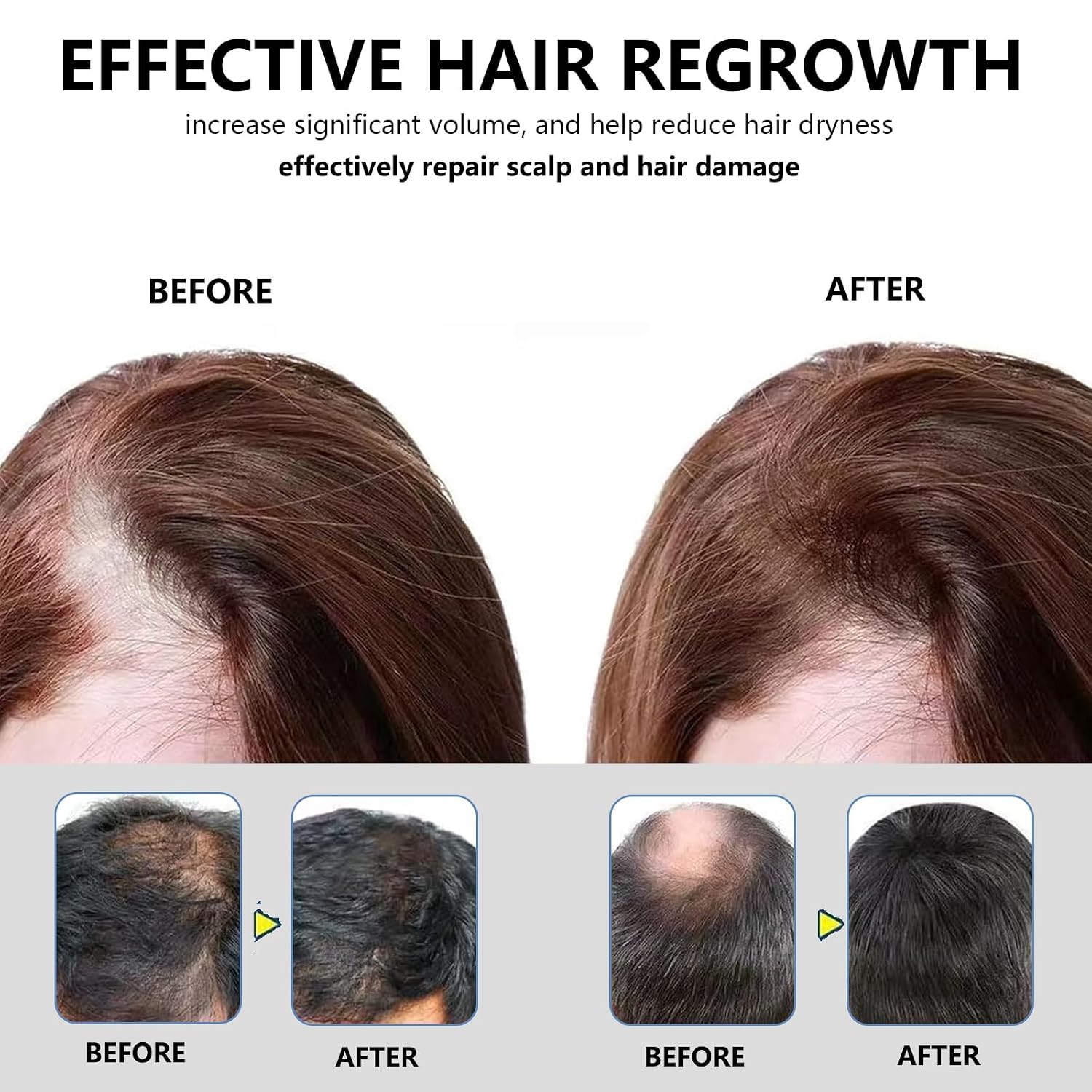 5% Hair Growth Scalp Massage Cream, Professional Hair Care Cream, Anti Hair Loss Treatment for Men & Women, Strengthens Hair Roots & Fast Regrowth (2PCS)