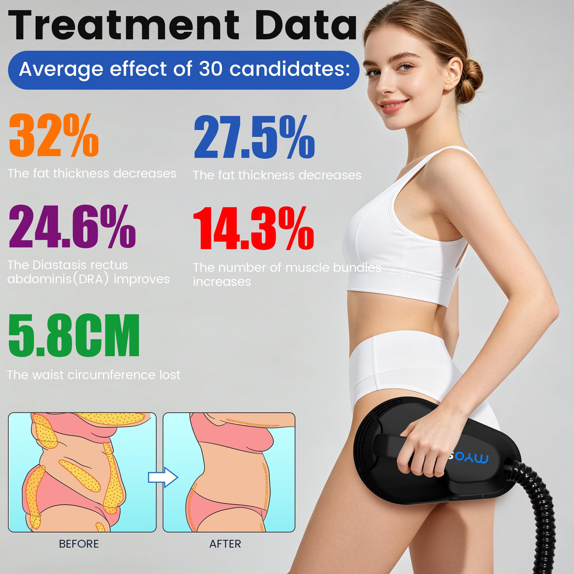Dispositivo de electroestimulación muscular (EMS) para moldear el cuerpo, esculpir el abdomen, las caderas y los brazos, reafirmar la piel, apto para uso doméstico o profesional, 4 asas, color negro