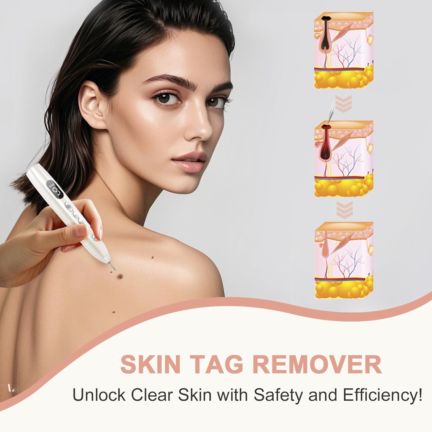 SkinTag Remover Kit, GCS-79 – Compact Beauty Kit Designed for Home Skin Care