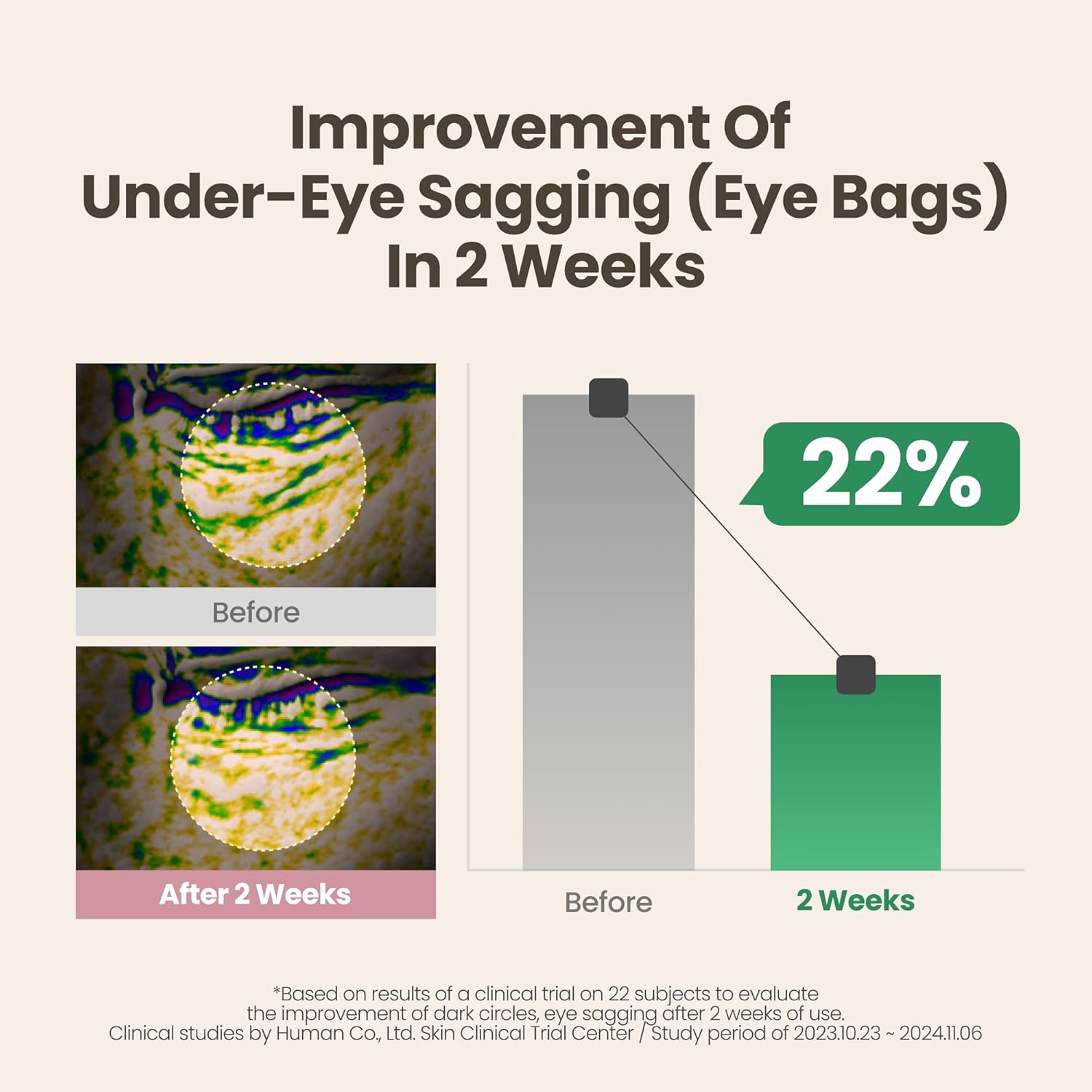 AXIS-Y Lip & Eye Set - Vita Glow Lip Oil Dreamy Olive & Vegan Collagen Eye Serum - Amazon Exclusive Korean Skin Care Kit - Limited Edition Hydra Barrier Duo for Lips & Eyes - Image 8