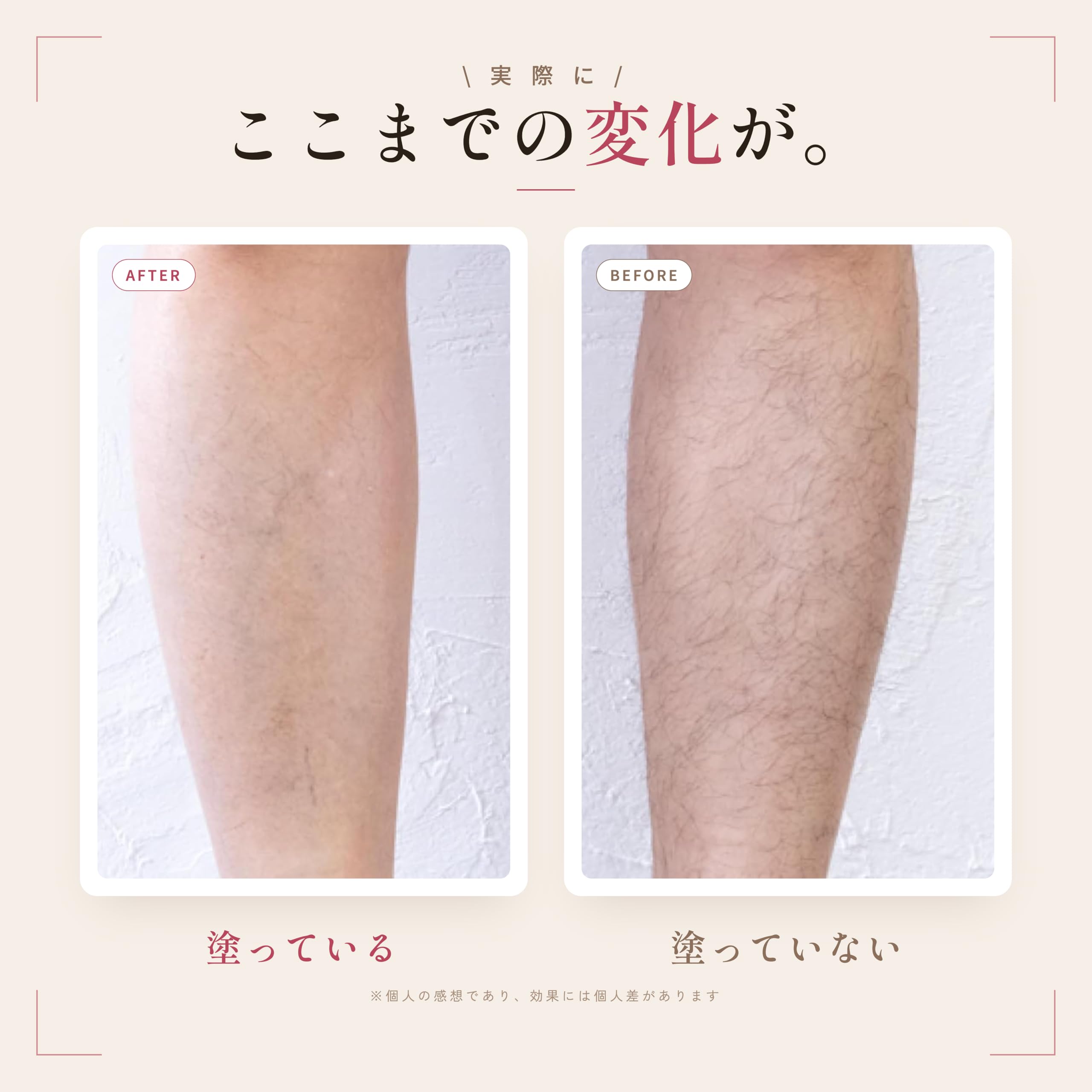Amazon.co.jp: ムダ毛 青ひげ 髭 剛毛ジェル メンズ 保湿 男性用 体毛