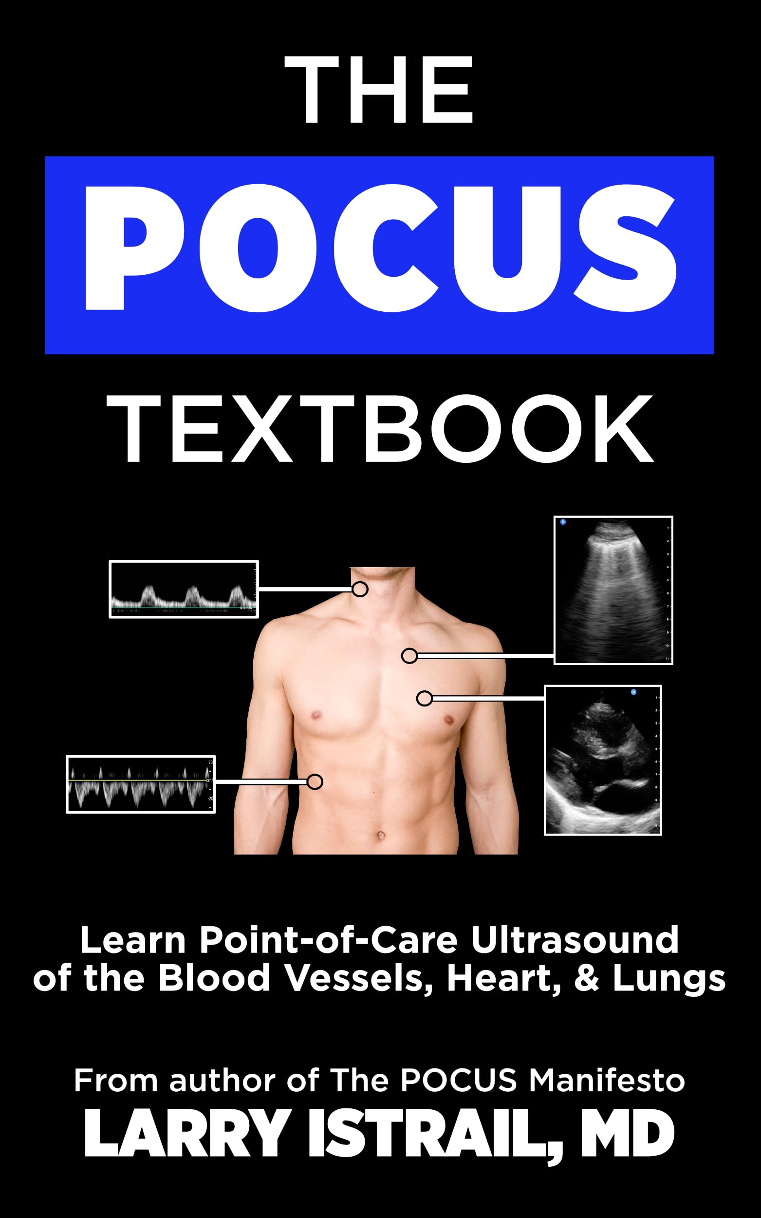 The POCUS Textbook: Learn Point-of-Care Ultrasound of the Blood Vessels, Heart, & Lungs (English Edition)