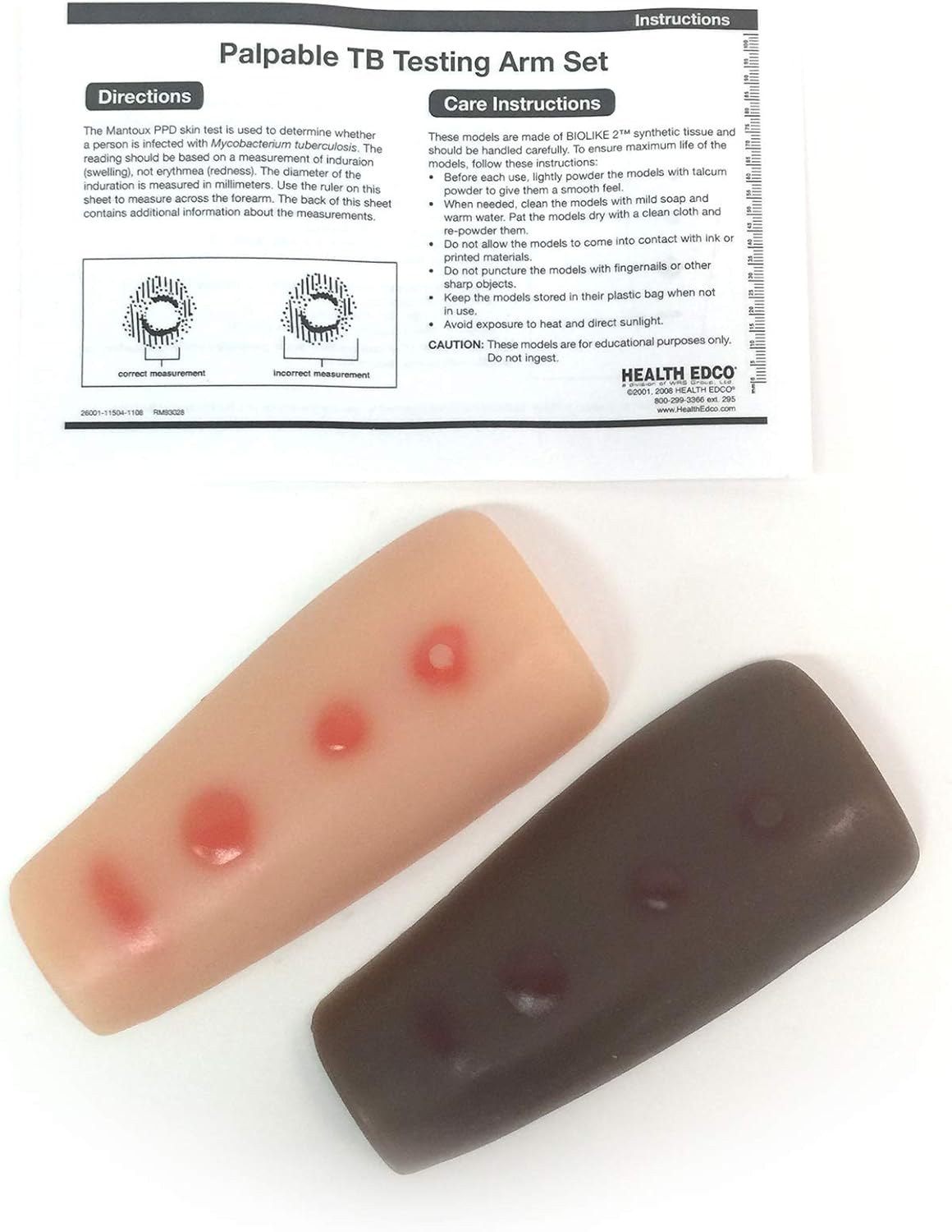 Palpable TB Testing Arm Set