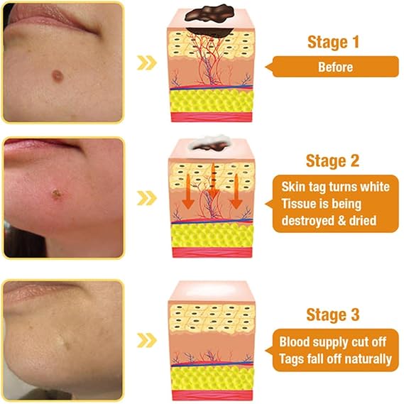Bee Venom Skin Treatment Cream, 2024 New Bee Venom Repair Cream, Professional Bee Venom Cream-30g, Repair Maximum Strength for All Skin Types (1 Bottle)