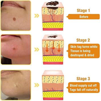 Bee Venom Skin Treatment Cream, 2024 New Bee Venom Repair Cream, Professional Bee Venom Cream-30g, Repair Maximum Strength for All Skin Types (1 Bottle)