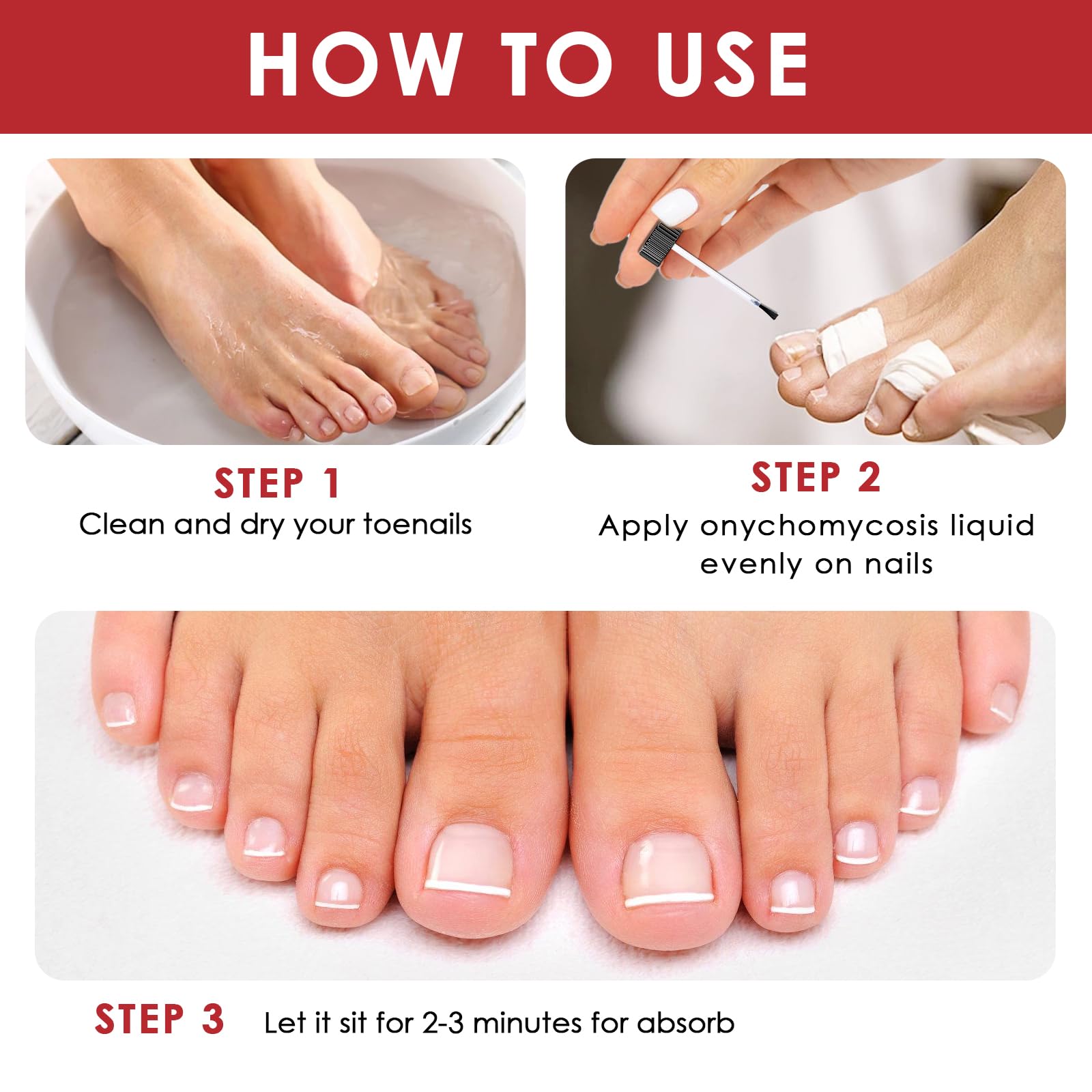 30ml Riparazione Unghie,Soluzione per la Cura delle Unghie,Liquido Cura unghia,per Migliorare l'Aspetto delle Unghies e Rinforzare la Struttura dell'Unghia,Uso Quotidiano