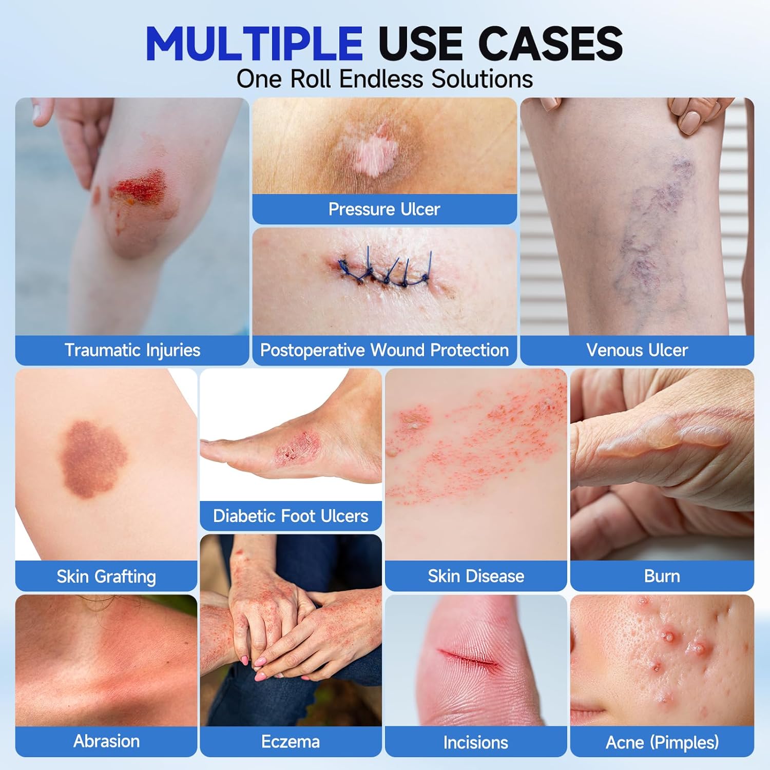 Hydrocolloid Roll for Wound Care - Medical Grade Self-Adhesive Gel Bandages, Ultra Absorbent & Waterproof Bandage, DIY Cut-to-Size First Aid Supply (2in×10ft) - Image 3