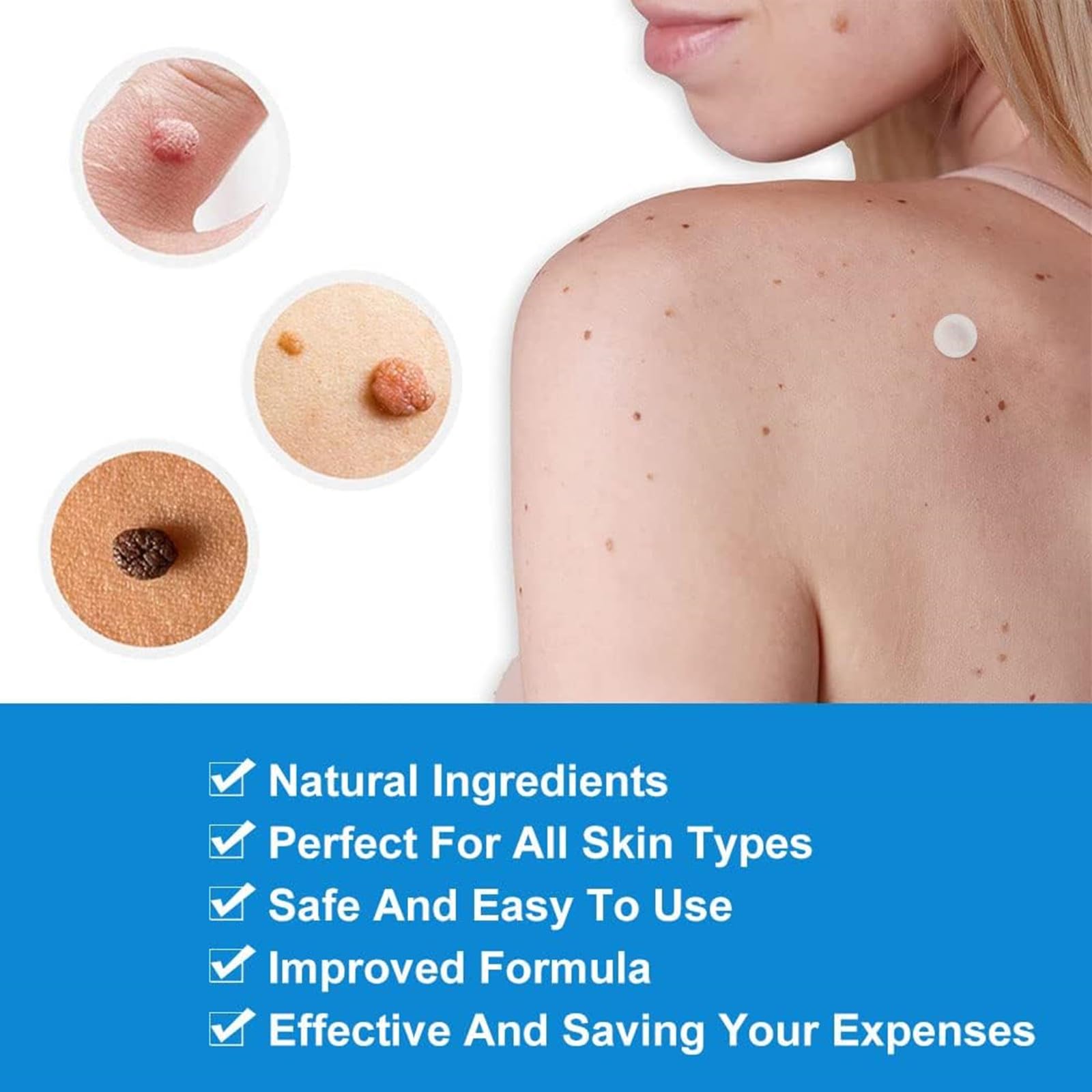 Skin Tag Removal Patches 144 Pieces for Wart and Mole Removal