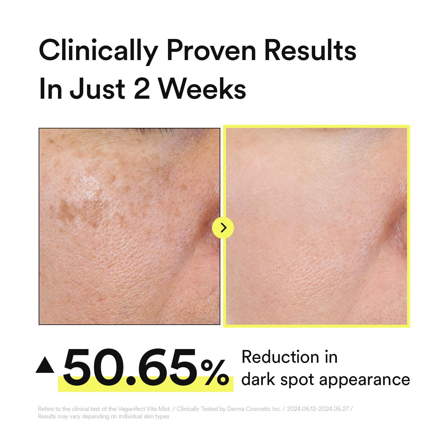 Vitamin C Glow Mist for Radiant Skin, Hydrating Serum Mist with Niacinamide & Glutathione, Korean Vegan Skincare, 3.38 Fl Oz - Image 6