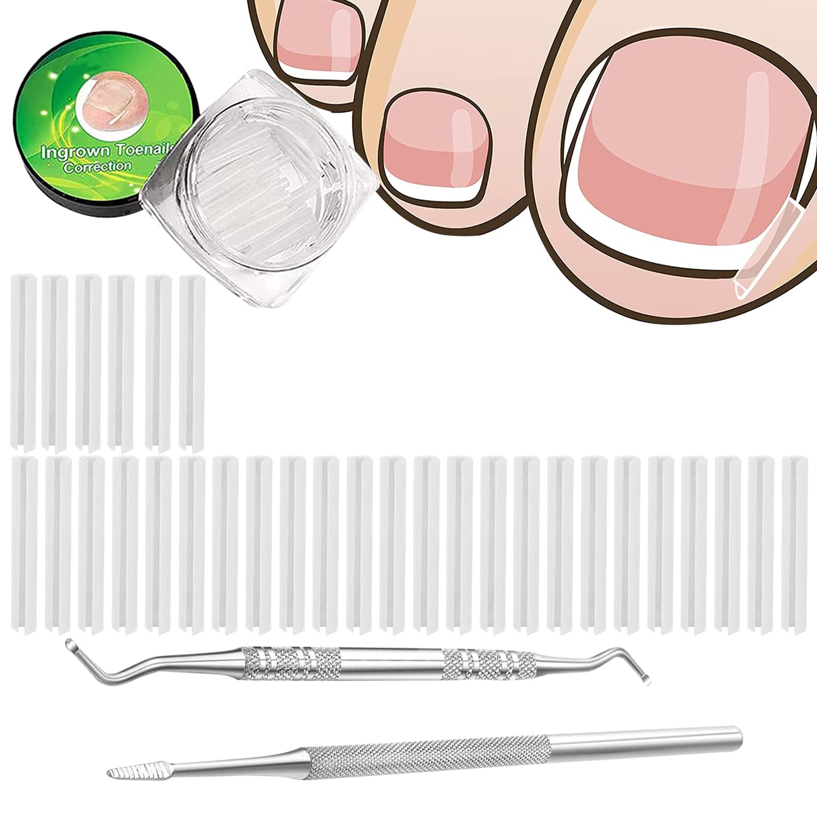 Tazweeq (30+2) Pack Ingrown Toenail Correction Treatment Kit, 30PCS Pedicure Tool Toenail Correction Patch, Ingrown Toenail Corrector Strips Brace Ingrown Toenail, 2PCS Ingrown Toenail Lifter, File
