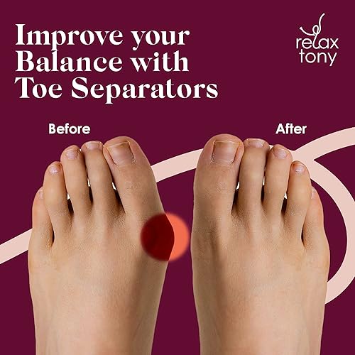 Miniatura 7 de Separadores de dedos para mayor comodidad y alineación  Separadores de dedos para aliviar el dolor de pies y corregir los dedos de los pies  Con