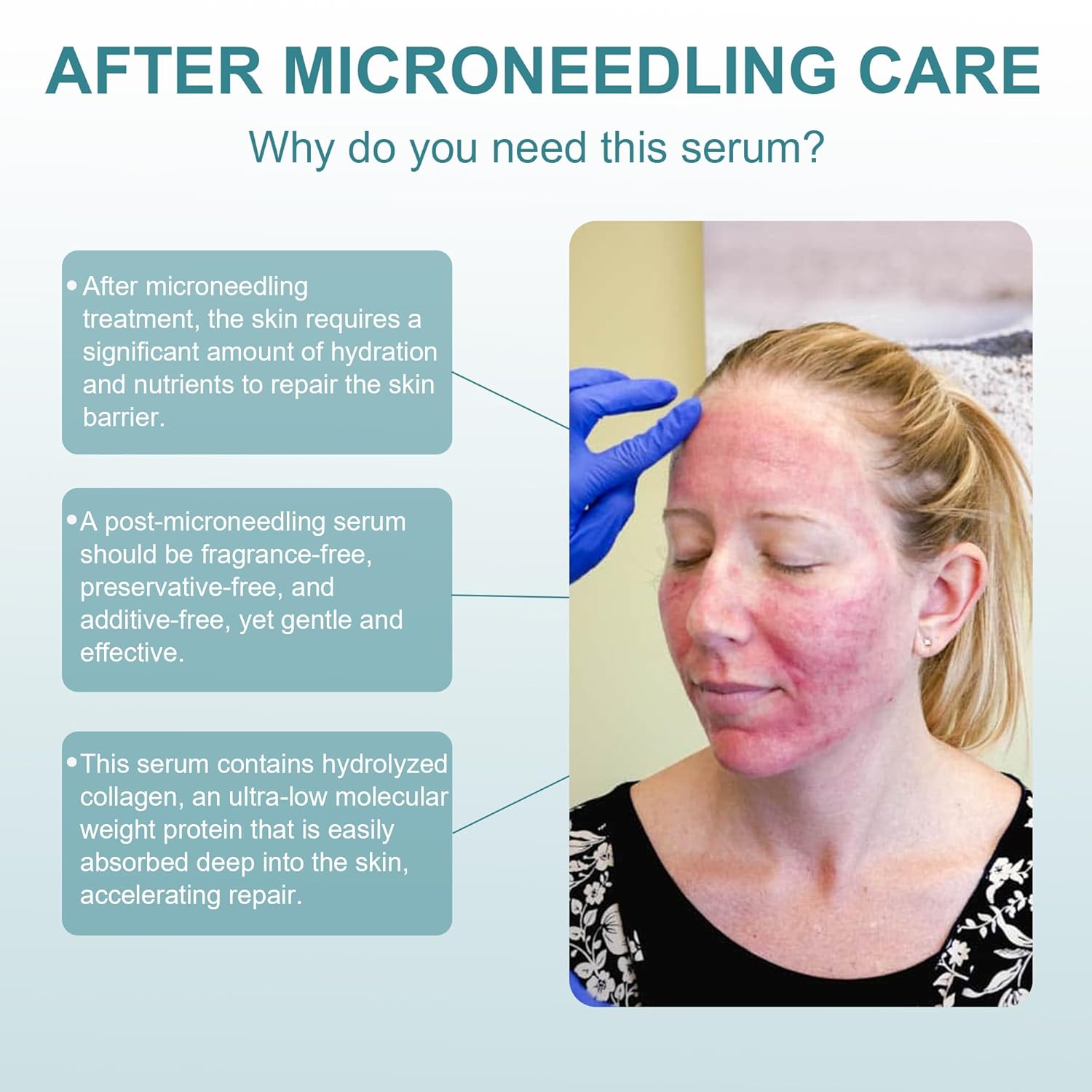 Post Microneedling Serum, After Microneedling Care, Tremella Extract+Freeze-Dried Hydrolyzed Collagen Serum, All Preservatives-Free, Instant Deep Hydration Smoothing, Soothing for Sensitive Skin(25ml)