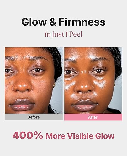 Miniatura 2 de Delere Máscara de envoltura de brillo caviar