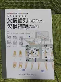見る目が変わる！欠損歯列の読み方 71eN8J9oq9L._AC_UF350,