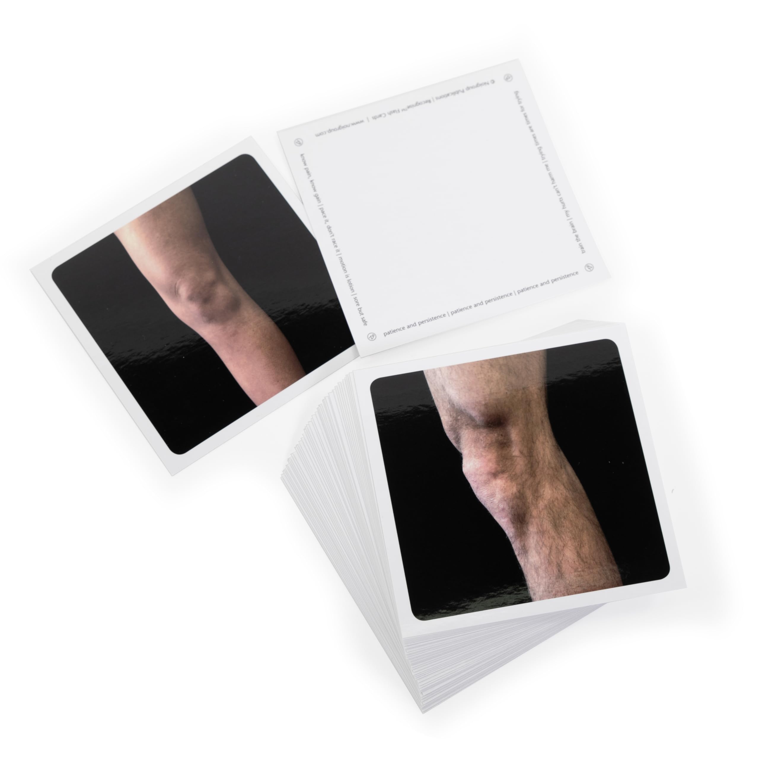 graded motor imagery cards Amazon.com: OPTP NOI Recognise Hand Flash Cards Perform Graded Motor Imagery Techniques to Test Left/Right Discrimination Abilities Non-Returnable : Industrial & Scientific
